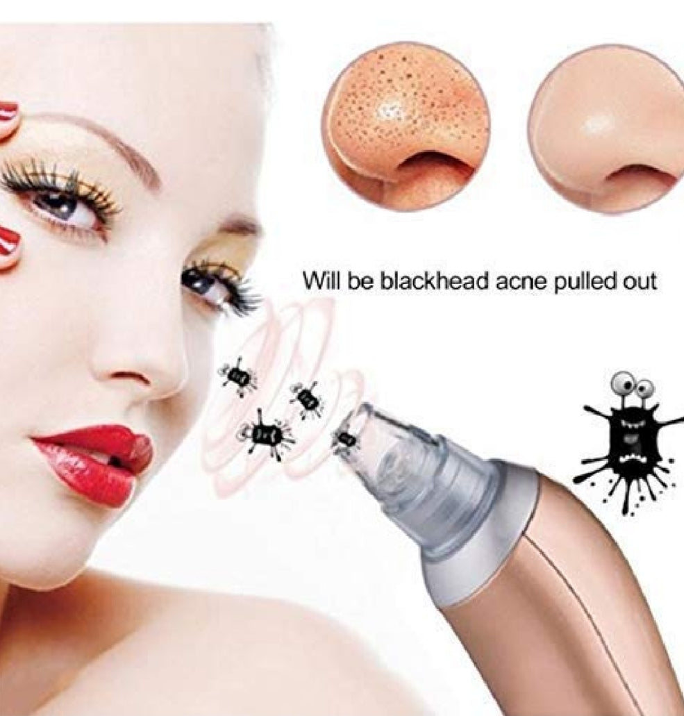 Blackhead Remover