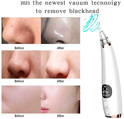 Blackhead Remover vacuum cleaner