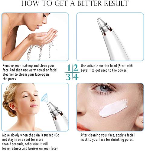 Blackhead Remover vacuum cleaner